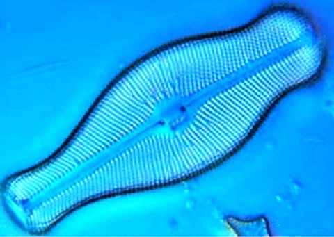 Didymo-bajo-el-microscopio