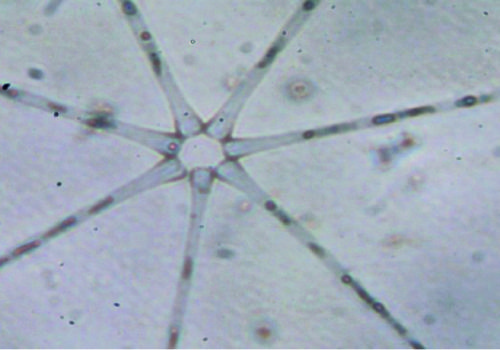 diatomea1 (1)