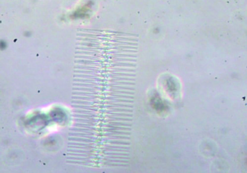 diatomea2 (1)